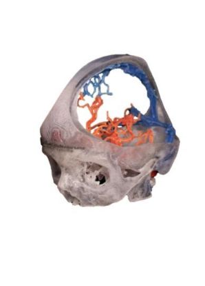 Picture of Circle of Willis in Skull