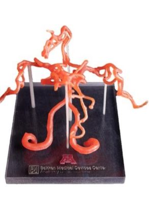 Picture of Circle of Willis on Platform