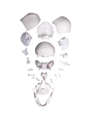 Picture of Skull Bones Separate