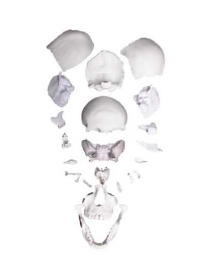 Picture of Skull Bones Separate