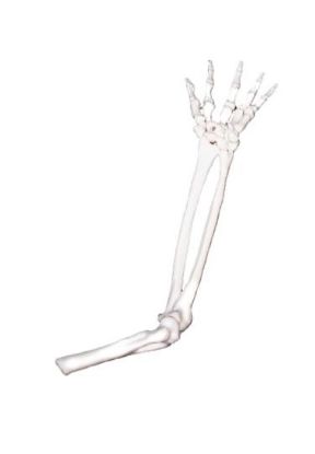 Picture of Forearm & Hand FDM Print