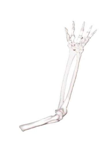 Picture of Forearm & Hand with BoneMatrix